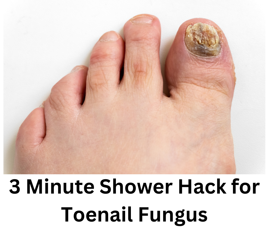 3 Minute Shower Hack for Toenail Fungus