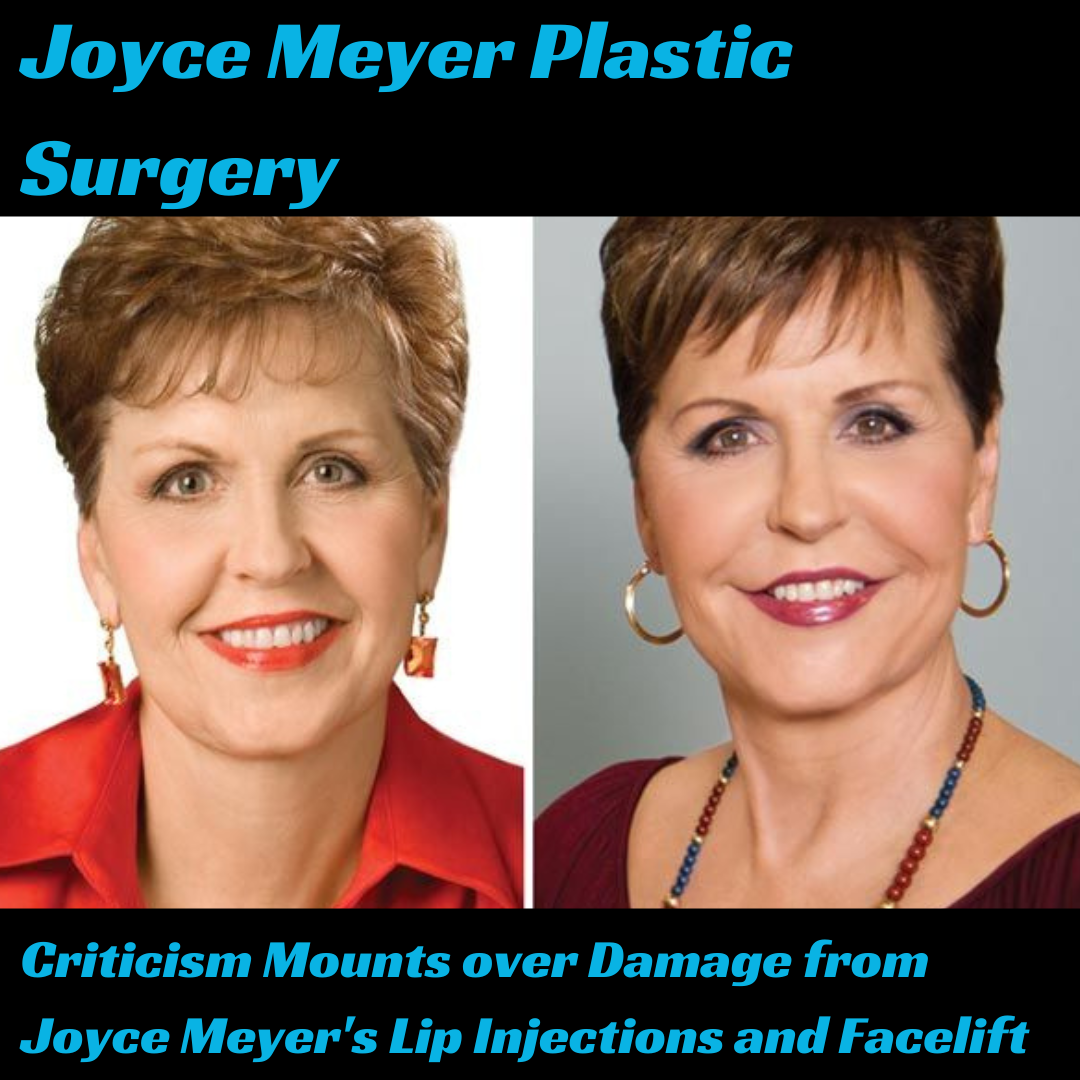 Joyce Meyer Plastic Surgery