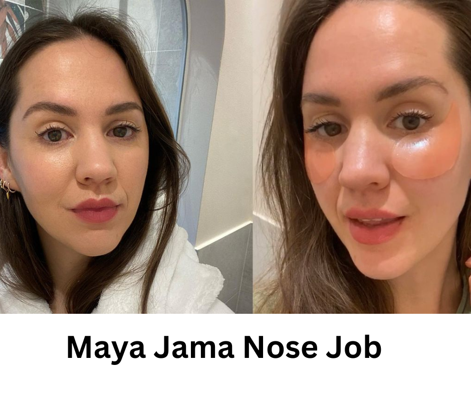 Maya Jama Nose Job