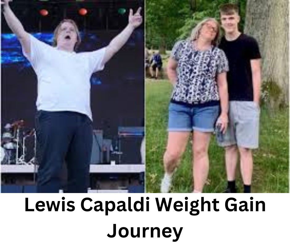 Lewis Capaldi Weight Gain