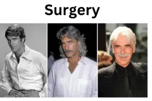 Sam Elliott Plastic Surgery