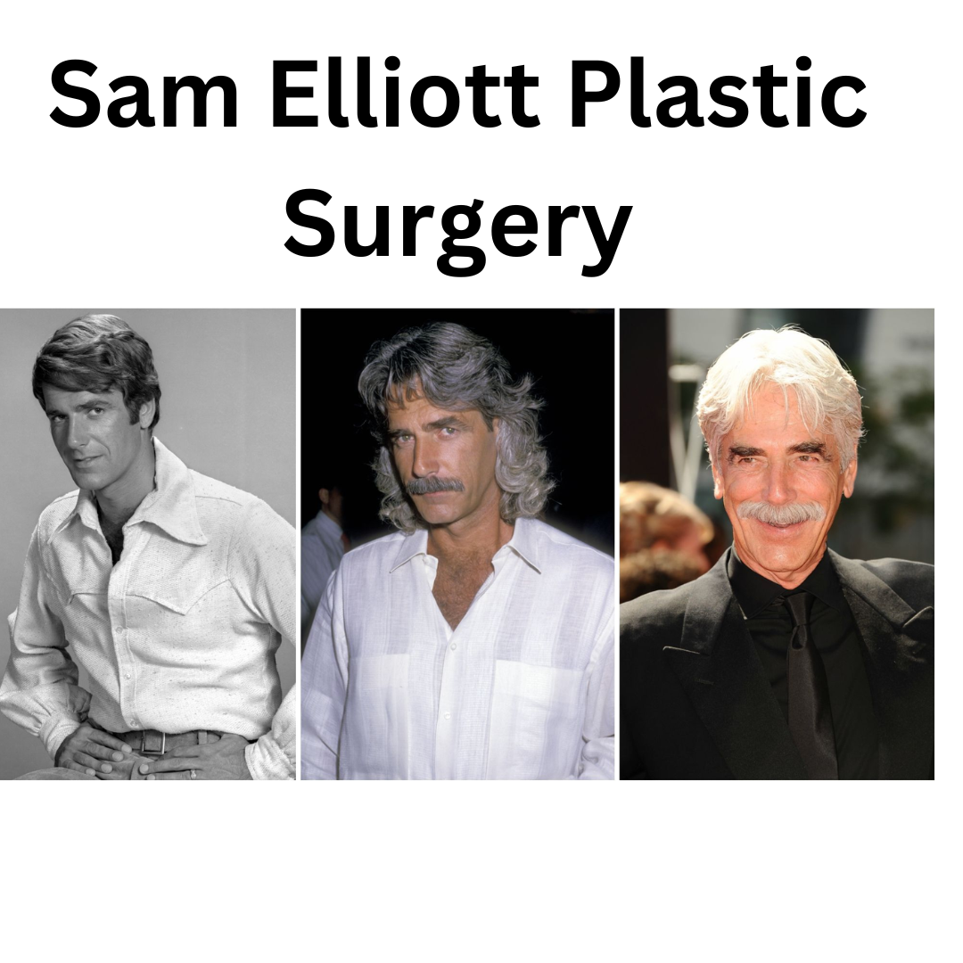 Sam Elliott Plastic Surgery